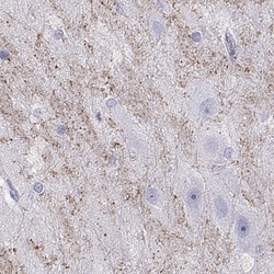 HHLA1 Antibody, Novus Biologicals:Antibodies:Primary Antibodies